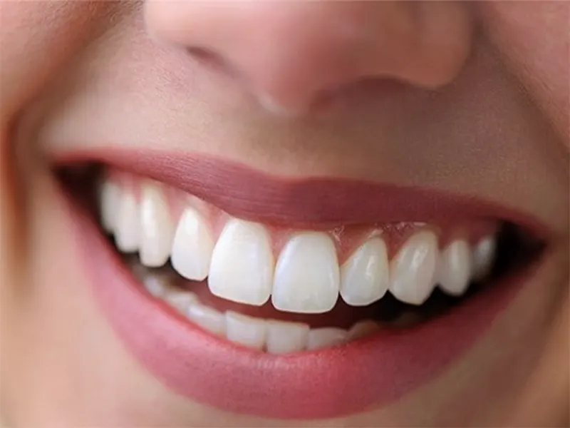 شروع یک درخشش