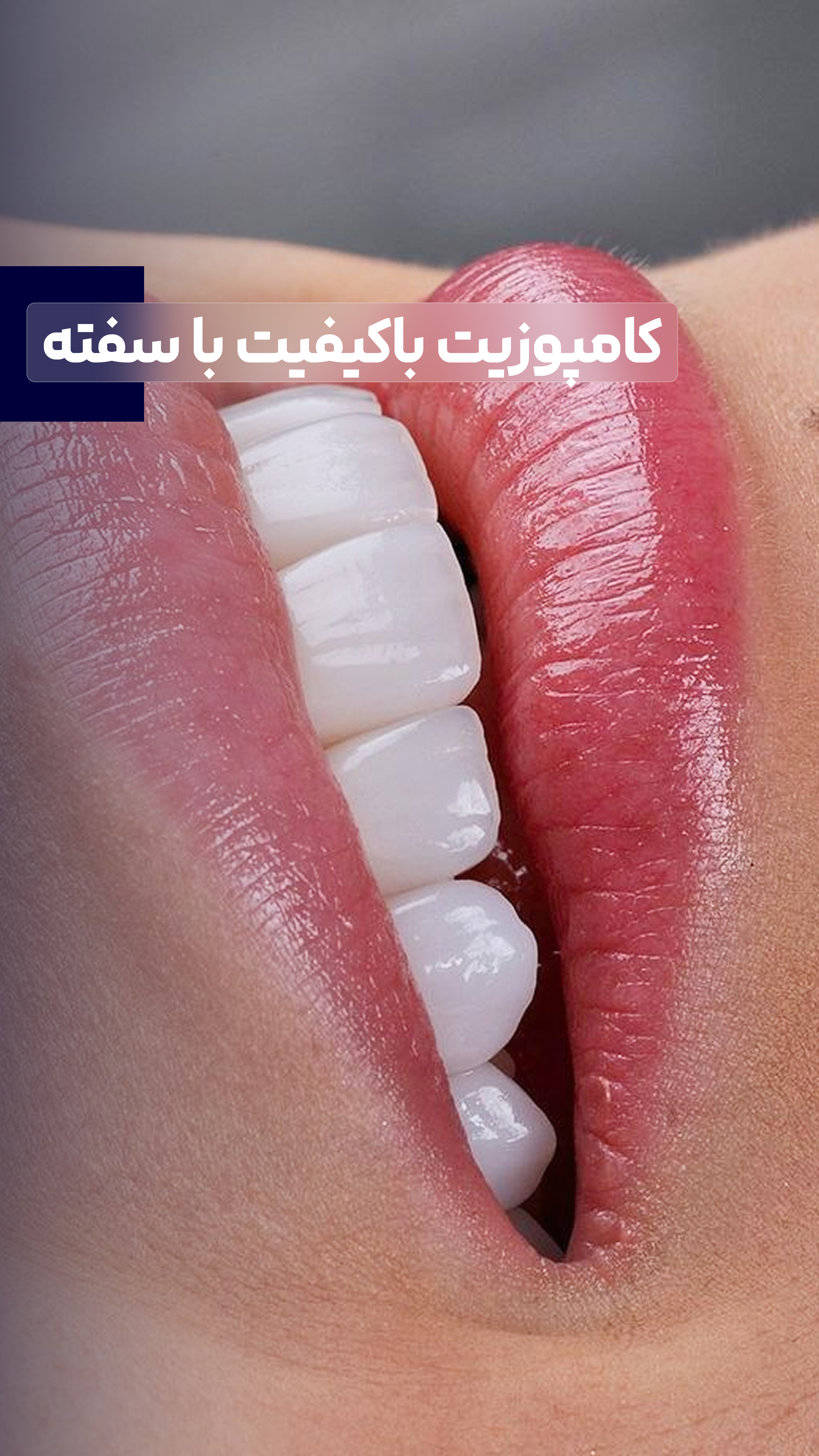 کامپوزیت