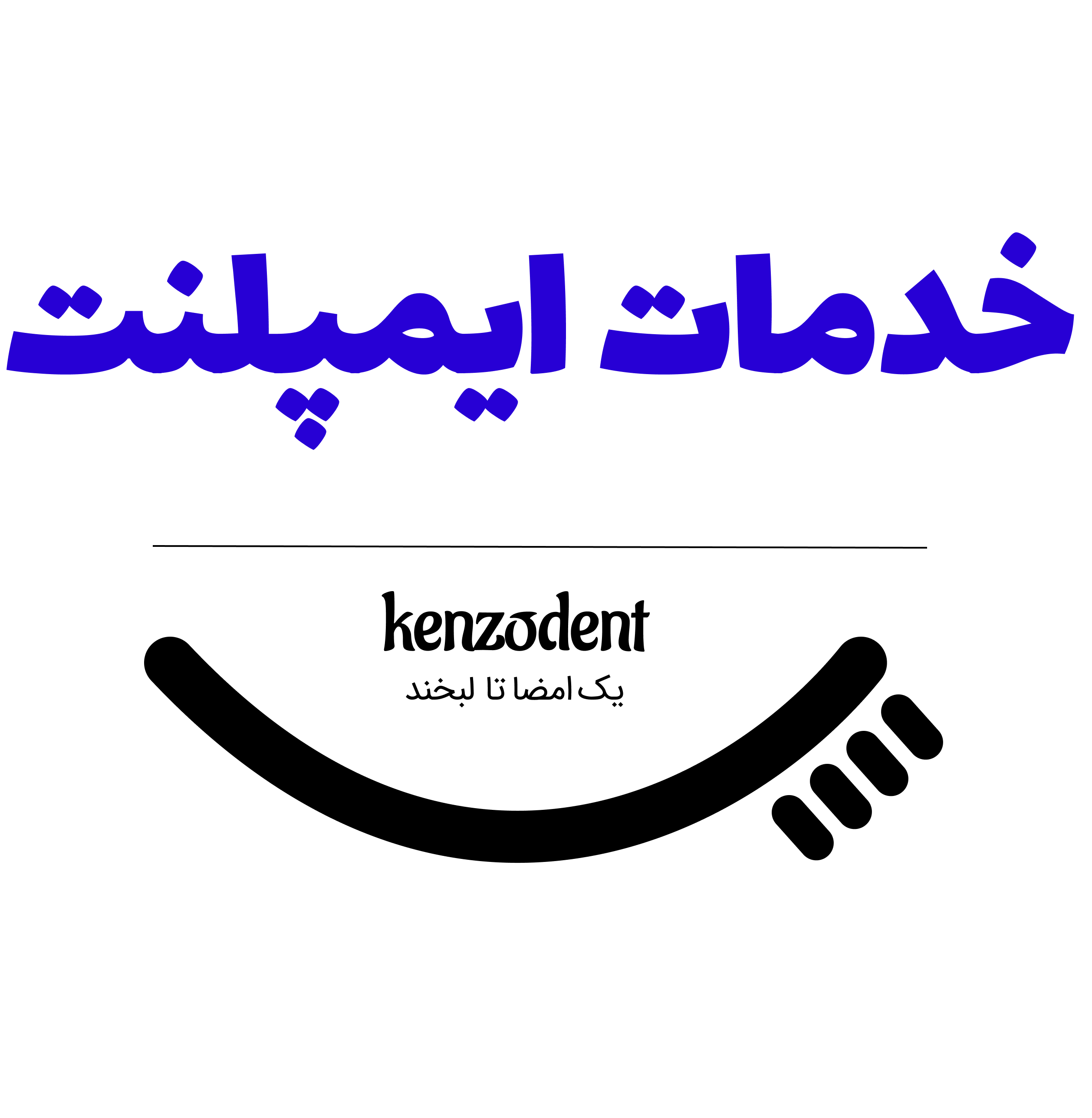 خدمات ایمپلنت کنزودنت