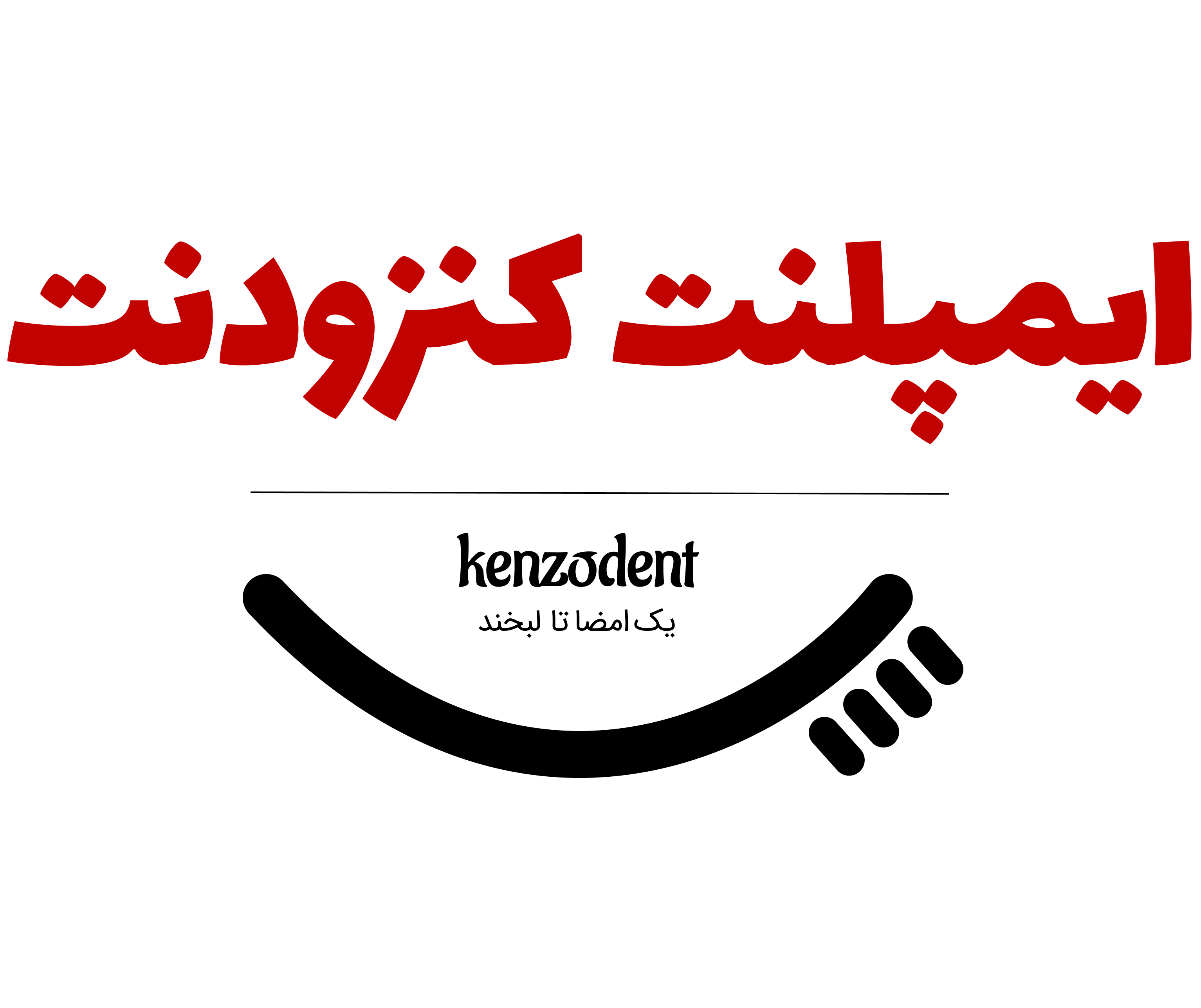 انجام خدمات ایمپلنت در مجموعه دندانپزشکی کنزودنت